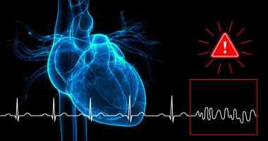 ensure cnn arrhythmia detection model reliability