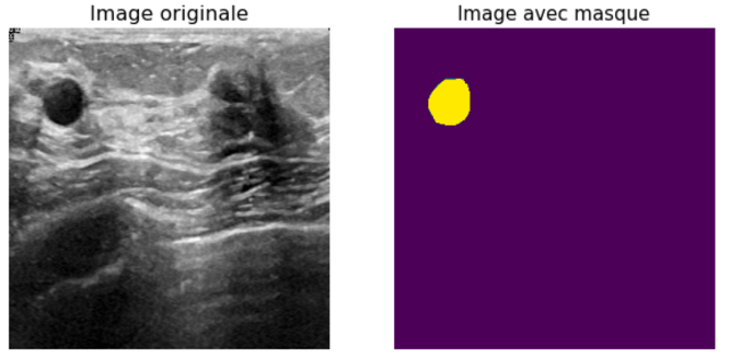 Images without tumor