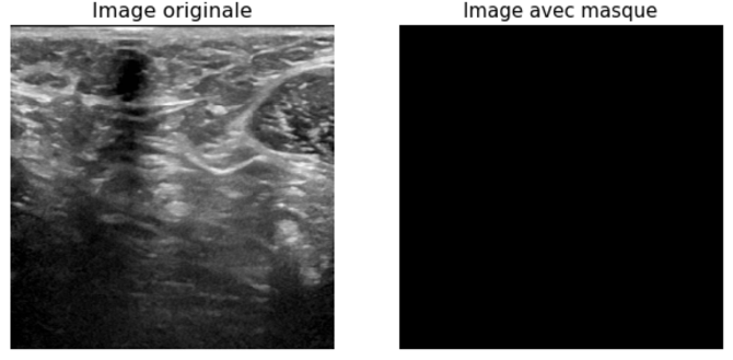 Images without tumor