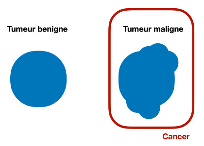 Comparative diagram between two types of tumor