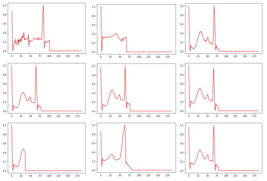 fig. 6 heart rhythms belonging to class 0 incorrectly classified