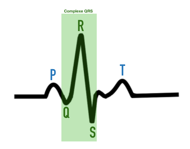 onde ecg